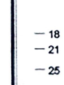 PUNTA CLAVAD.NEUM BRADS 10000
